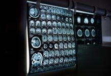 Jak się robi tomografię komputerową?
