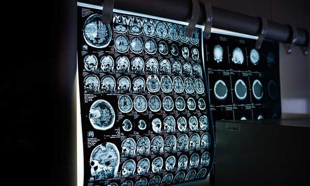 Co jest droższe rezonans czy tomografia?