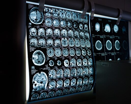Czy lekarz rodzinny może wystawić skierowanie na tomografię komputerową?